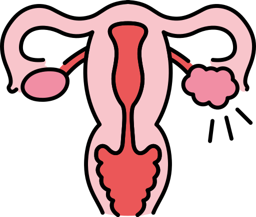 PCOS Symptom Tracker 
